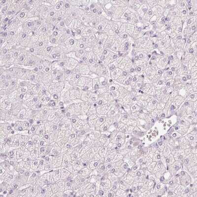 Immunohistochemistry-Paraffin: MUC5AC Antibody [NBP2-31986]
