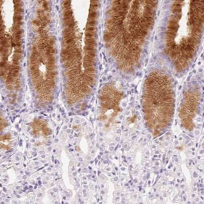 Immunohistochemistry-Paraffin: MUC5AC Antibody [NBP2-31986]
