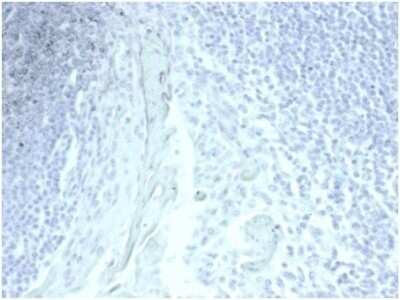 Immunohistochemistry-Paraffin: MUC5AC Antibody (MUC5AC/7067R) [NBP3-13975]