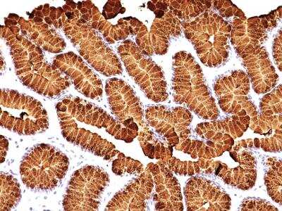Immunohistochemistry-Paraffin: MUC5AC Antibody (MUC5AC/917 + 45M1) - IHC-Prediluted [NBP2-48429]