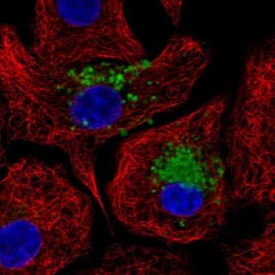 Immunocytochemistry/ Immunofluorescence: MUC5B Antibody [NBP1-92151]