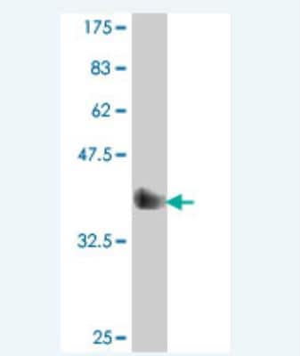 Western Blot: MUC5B Antibody [H00727897-A01]