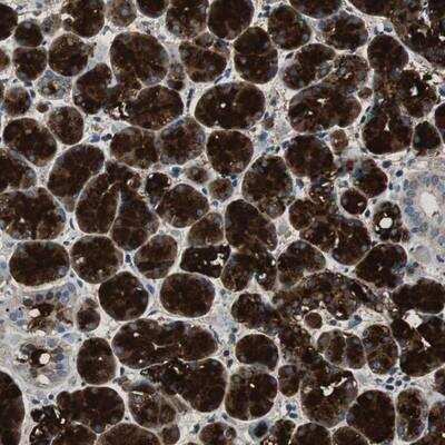 Immunohistochemistry-Paraffin: MUC7 Antibody [NBP1-82045]