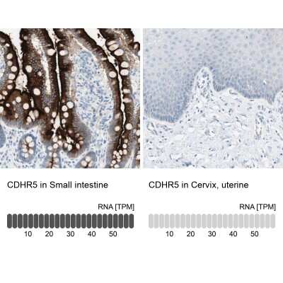 Immunohistochemistry-Paraffin: MUCDHL Antibody [NBP1-92149]