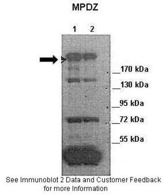 Western Blot: MUPP1 Antibody [NBP1-54331]