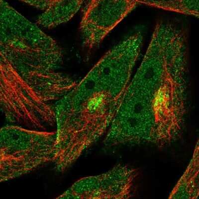 Immunocytochemistry/ Immunofluorescence: MURC Antibody [NBP1-86609]