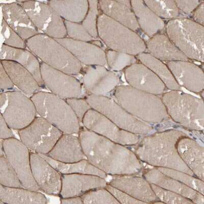 Immunohistochemistry-Paraffin: MURC Antibody [NBP1-86607]
