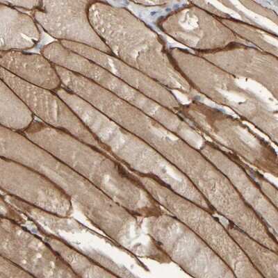 Immunohistochemistry-Paraffin: MURC Antibody [NBP1-86609]