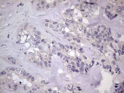 Immunohistochemistry: MURF3 Antibody (OTI7F8) [NBP2-46224]