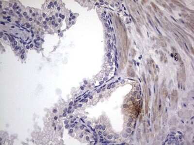 Immunohistochemistry: MURF3 Antibody (OTI7F8) [NBP2-46224]