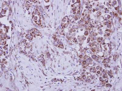 Immunohistochemistry-Paraffin: MuSK Antibody [NBP2-15028]