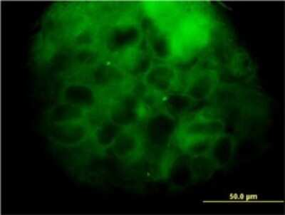 Immunocytochemistry/ Immunofluorescence: MVD Antibody (2A7) [H00004597-M01]