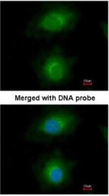 Immunocytochemistry/ Immunofluorescence: MVD Antibody [NBP1-33050]