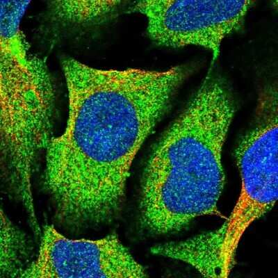 Immunocytochemistry/ Immunofluorescence: MVD Antibody [NBP2-13628]