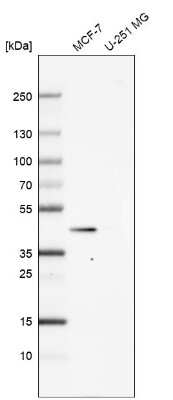 Western Blot: MVD Antibody [NBP2-13629]