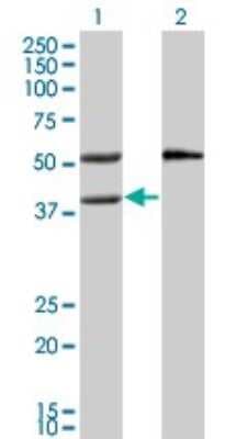 Western Blot: MVK Antibody (2C5) [H00004598-M02]