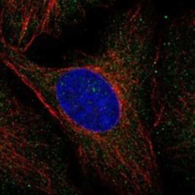 Immunocytochemistry/ Immunofluorescence: MVK Antibody [NBP3-17741]