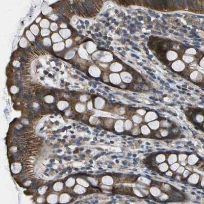 Immunohistochemistry-Paraffin: MVK Antibody [NBP1-82824]