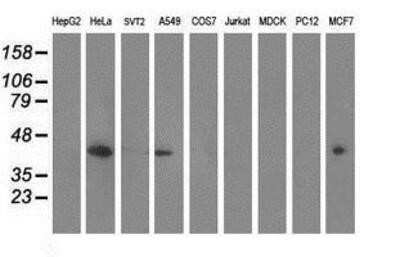 Western Blot: MVK Antibody (OTI 1D7) [NBP2-00775]