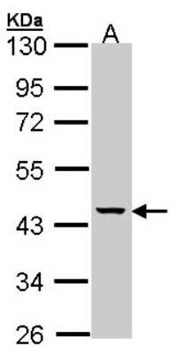 Western Blot: MVK Antibody [NBP1-32868]