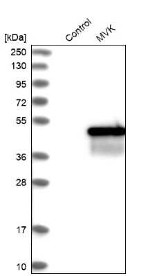 Western Blot: MVK Antibody [NBP1-82824]