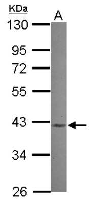 Western Blot: MVK Antibody [NBP2-19447]