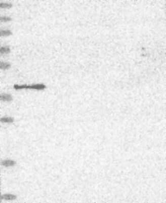 Western Blot: MVK Antibody [NBP3-17741]