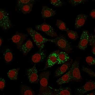Immunocytochemistry/ Immunofluorescence: MVP Antibody (1014) [NBP2-44400]