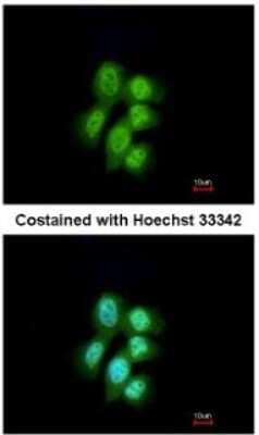 Immunocytochemistry/ Immunofluorescence: MVP Antibody [NBP1-33560]