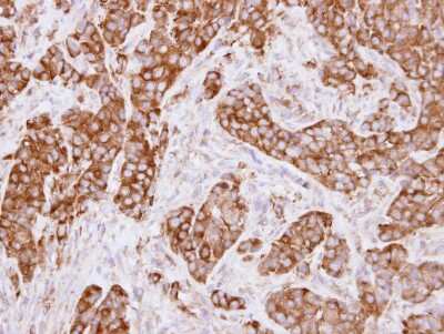 Immunohistochemistry-Paraffin: MVP Antibody [NBP1-33560]