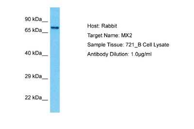 Western Blot: MX2 Antibody [NBP2-85341]