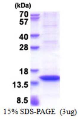 SDS-PAGE: Recombinant Human MX2 His Protein [NBP2-51530]
