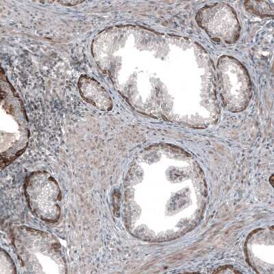 Immunohistochemistry-Paraffin: MXRA8/DICAM Antibody [NBP2-30993]