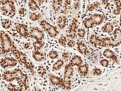 Immunohistochemistry-Paraffin: MYB Antibody [NBP2-98885]