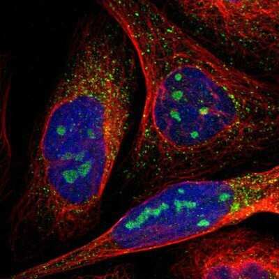 Immunocytochemistry/ Immunofluorescence: MYBBP1A Antibody [NBP2-13630]
