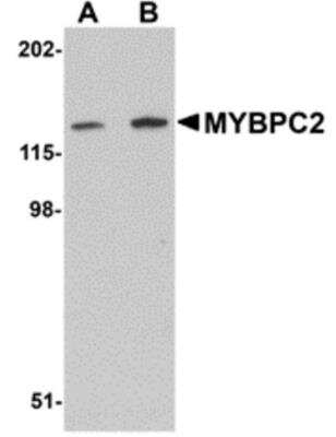 Western Blot: MYBPC2 AntibodyBSA Free [NBP1-77133]