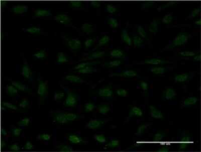 Immunocytochemistry/ Immunofluorescence: MYCBP Antibody (1F10) [H00026292-M08]