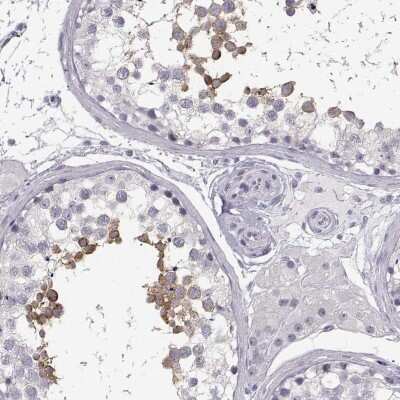 Immunohistochemistry-Paraffin: MYCBPAP Antibody [NBP2-14790]
