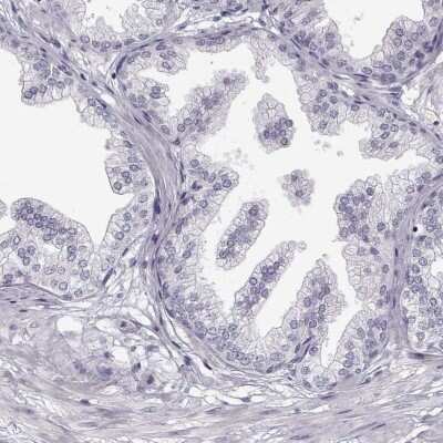 Immunohistochemistry-Paraffin: MYCBPAP Antibody [NBP2-14790]