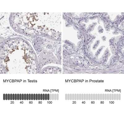 Immunohistochemistry-Paraffin: MYCBPAP Antibody [NBP2-14790]