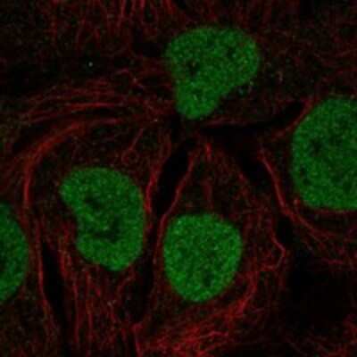 Immunocytochemistry/ Immunofluorescence: MYCL1/L-Myc Antibody [NBP3-17894]