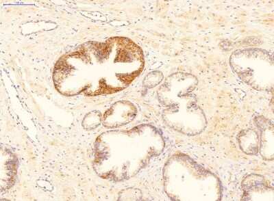 Immunohistochemistry: MYD118 Antibody [NBP1-58997]