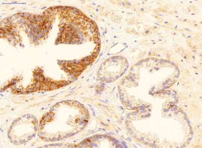 Immunohistochemistry: MYD118 Antibody [NBP1-58997]