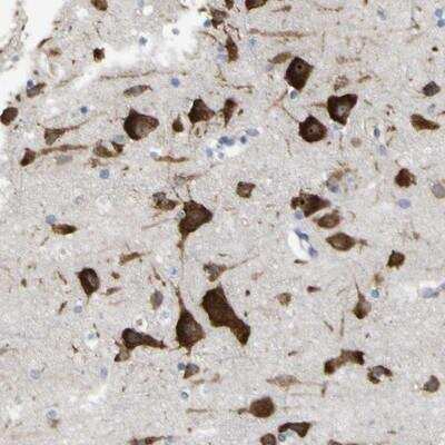 Immunohistochemistry-Paraffin: MYEOV Antibody [NBP1-80974]