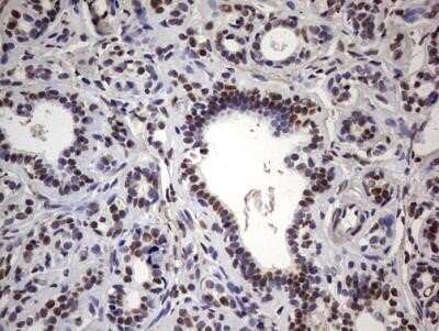 Immunohistochemistry: MYF-5 Antibody (OTI2G5) - Azide and BSA Free [NBP2-72855]