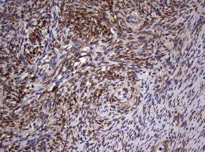 Immunohistochemistry-Paraffin: MYF-5 Antibody (OTI2G5) [NBP2-44245]