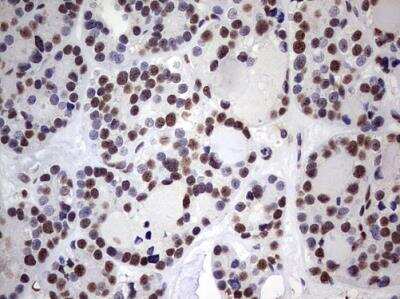 Immunohistochemistry-Paraffin: MYF-5 Antibody (OTI2G5) [NBP2-44245]