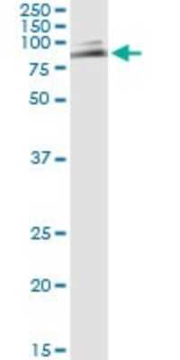 Immunoprecipitation: MYH Antibody (4D10) [H00004595-M01]