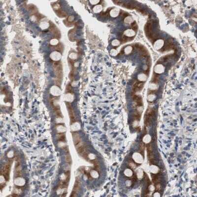 Immunohistochemistry-Paraffin: MYH Antibody [NBP1-87743]