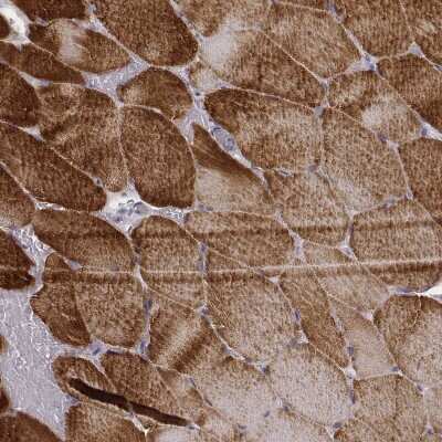 Immunohistochemistry-Paraffin: MYH6 Antibody (CL2148) [NBP2-36744]